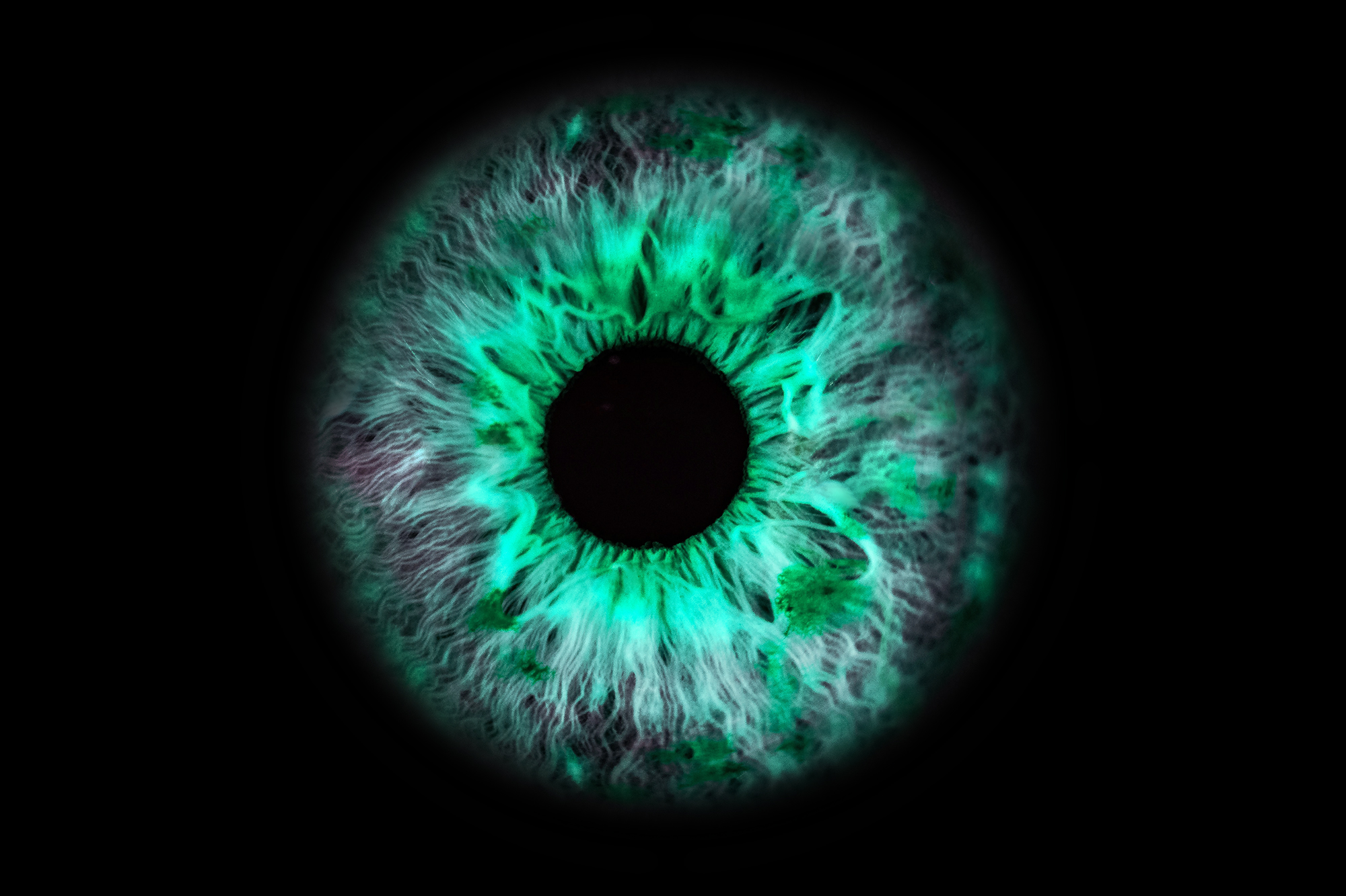Qvido eyecare technology eye